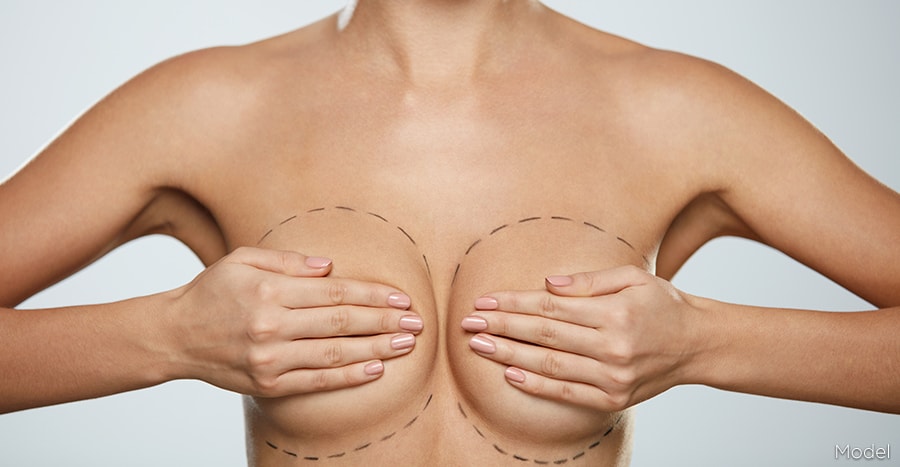 Is Breast implants Miami a good option?